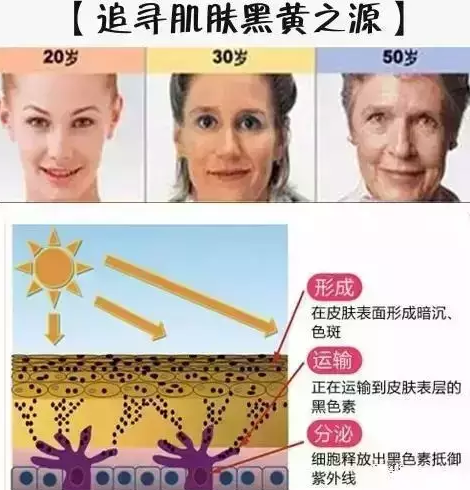 导致皮肤暗黄