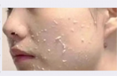 [石家庄化妆学校]脸部搓泥?护肤品不吸收?到底是谁的锅