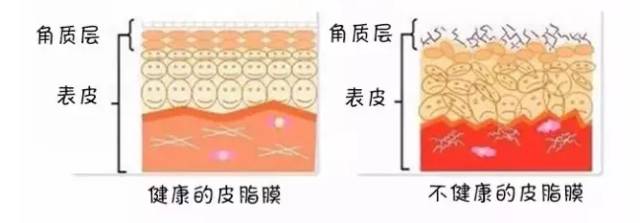 皮脂膜